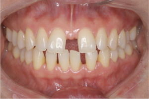 志木　矯正　歯医者