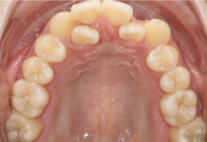 志木　矯正　歯医者