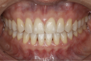 志木　矯正　歯医者