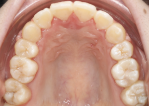 志木　矯正　歯医者