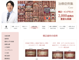 志木　歯医者　矯正