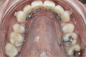 志木　矯正　歯医者