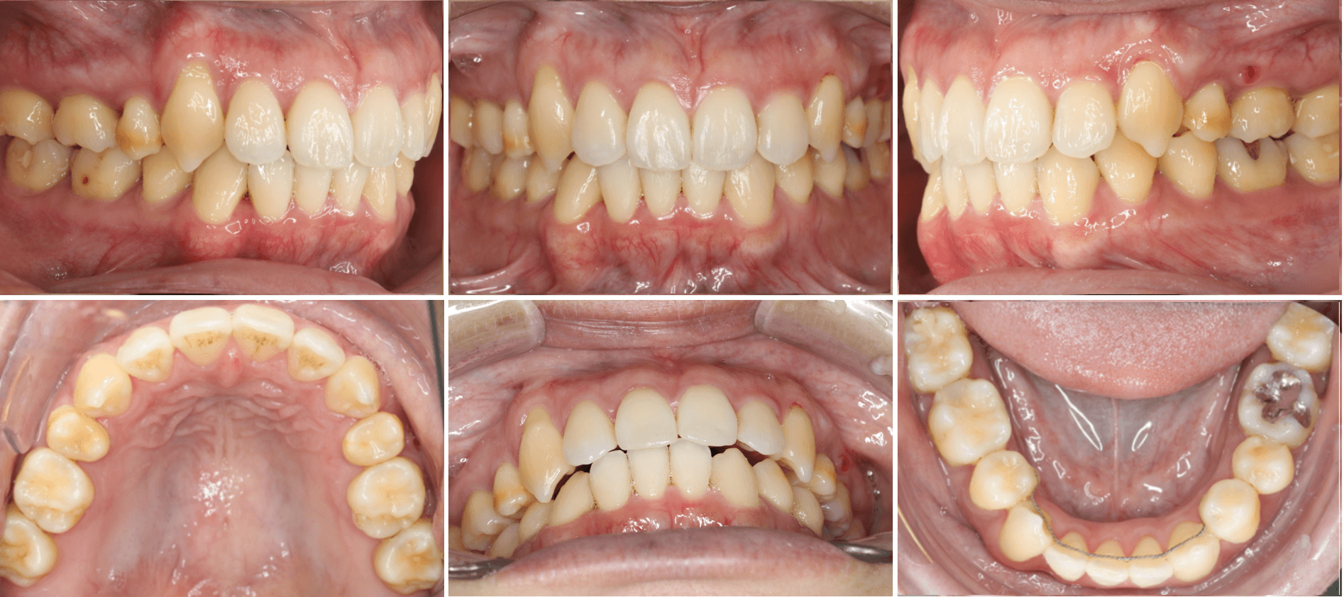 志木 歯医者 矯正