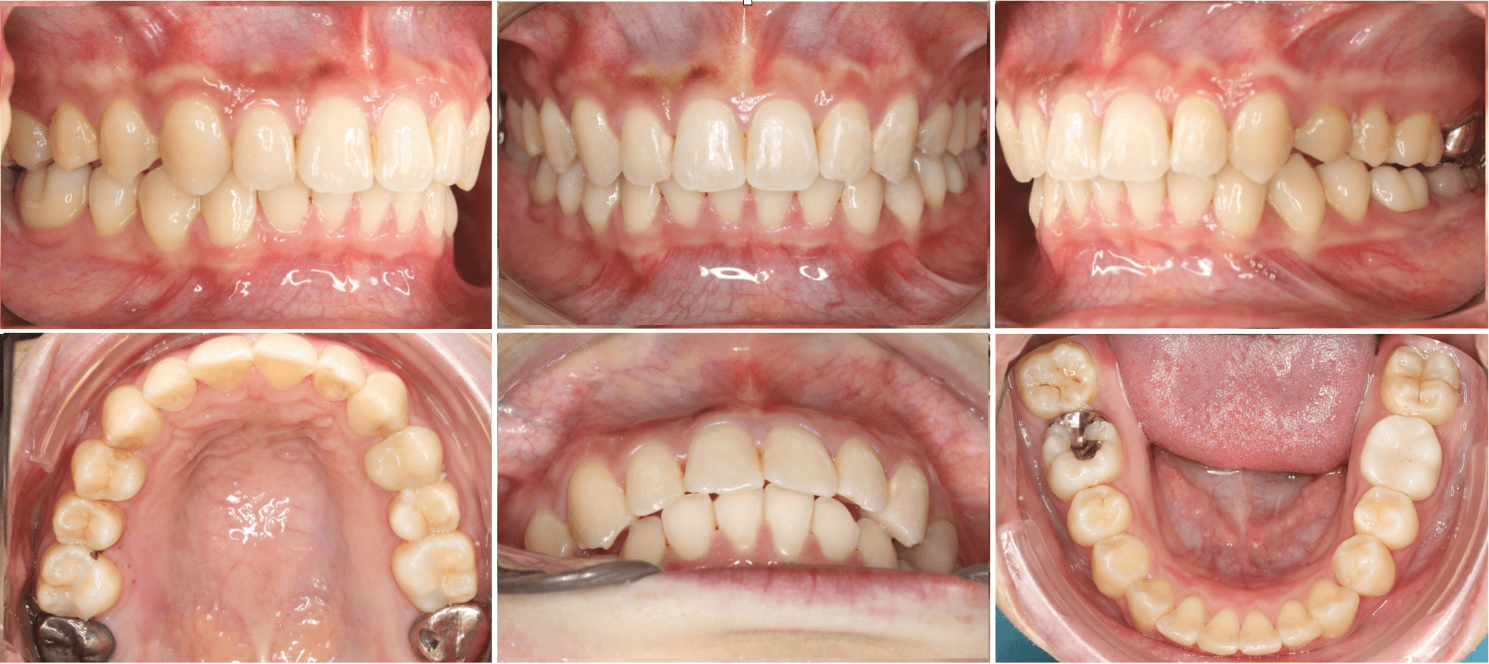 志木 歯医者 矯正