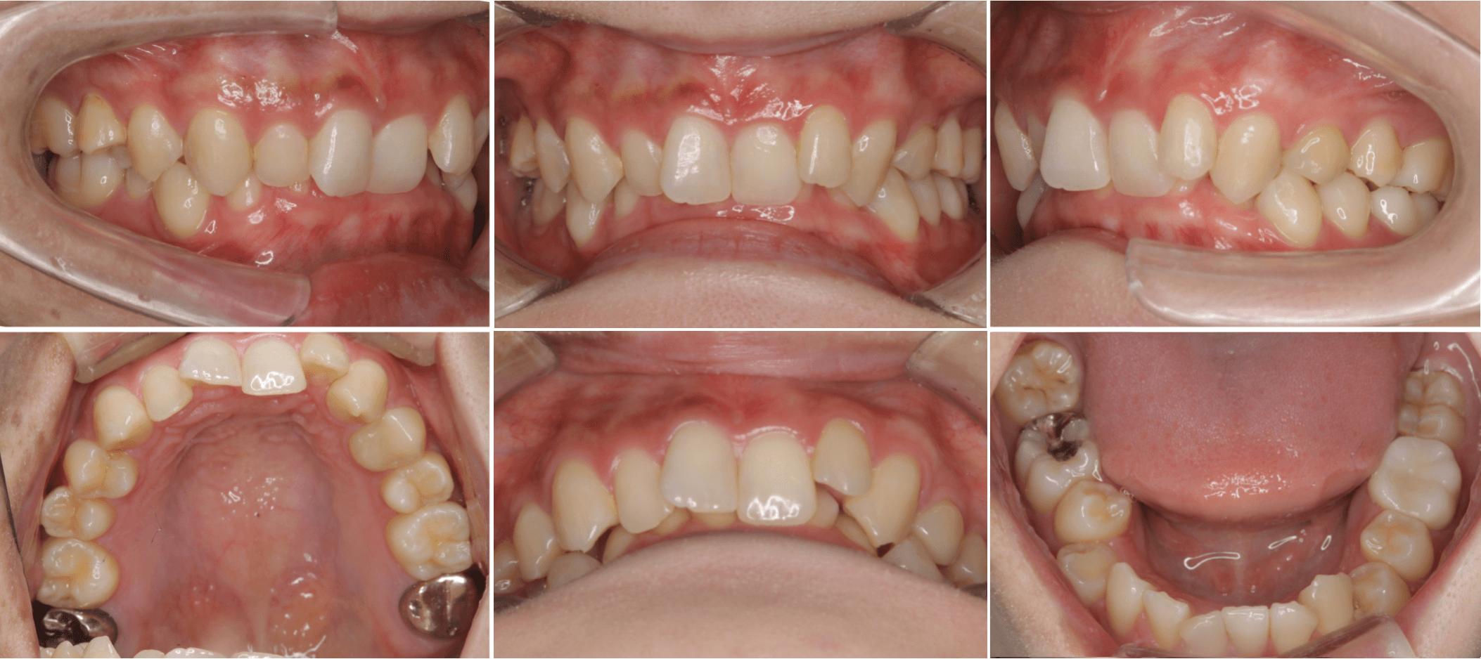 志木 歯医者 矯正