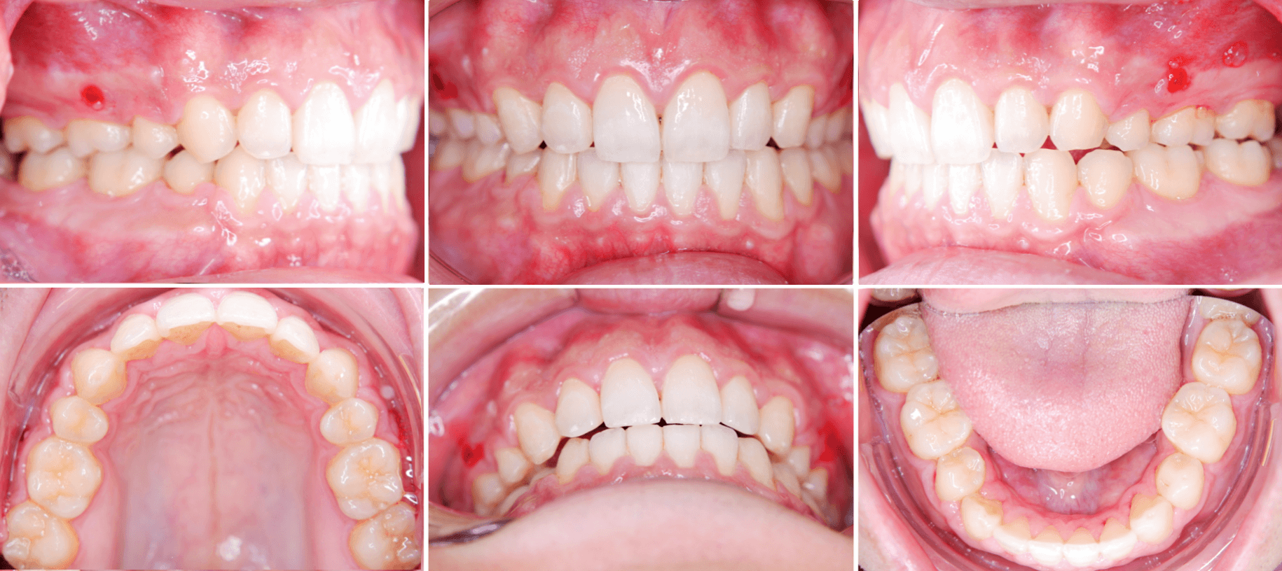 志木 歯医者 矯正