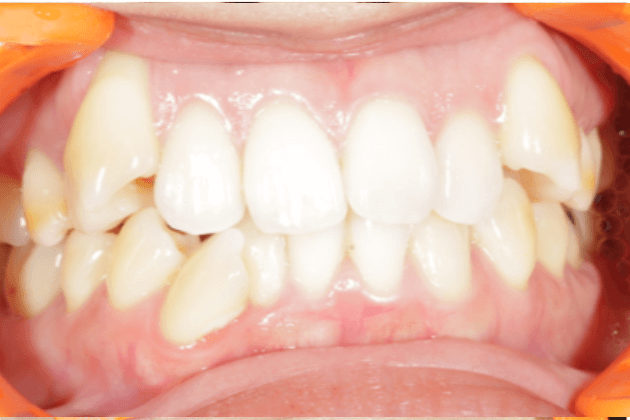 志木 歯医者 矯正