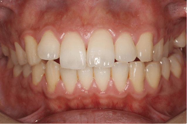 志木 歯医者 矯正