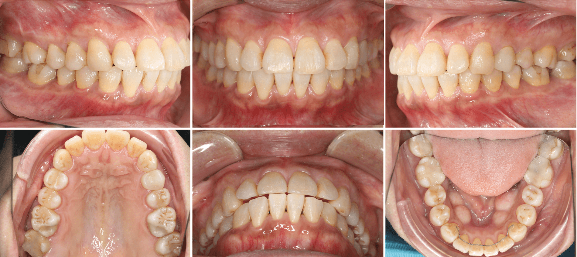 志木 歯医者 矯正