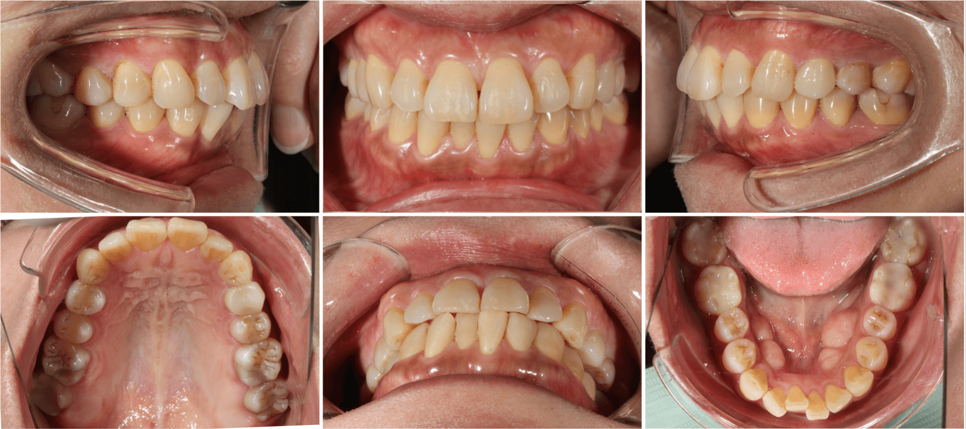 志木 歯医者 矯正