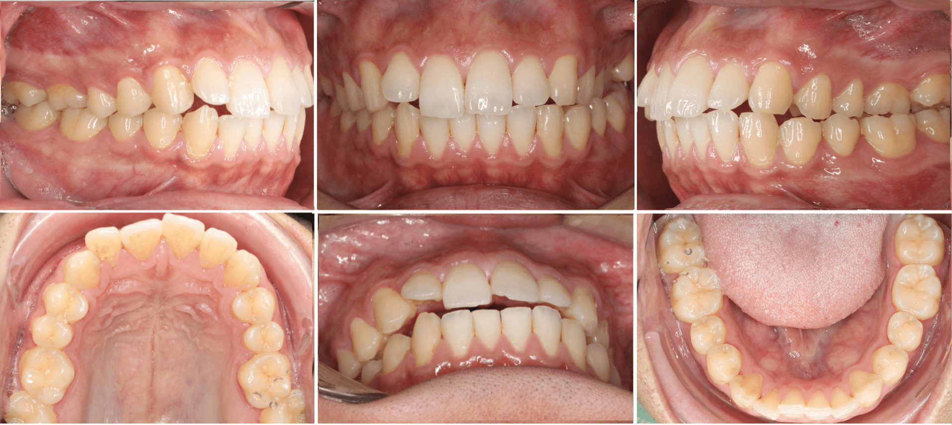志木 歯医者 矯正