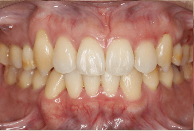 志木 歯医者 矯正