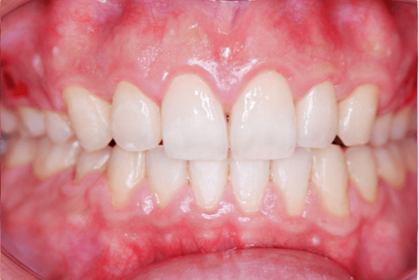 志木 歯医者 矯正