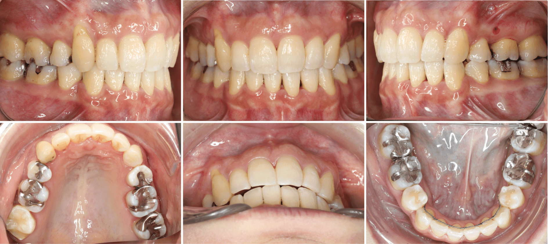 志木　歯医者　矯正