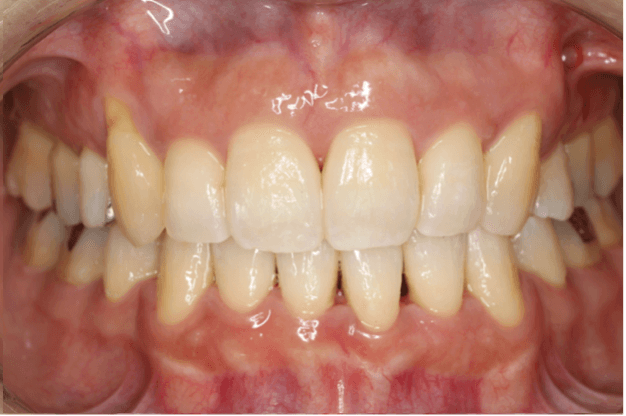 志木　歯医者　矯正