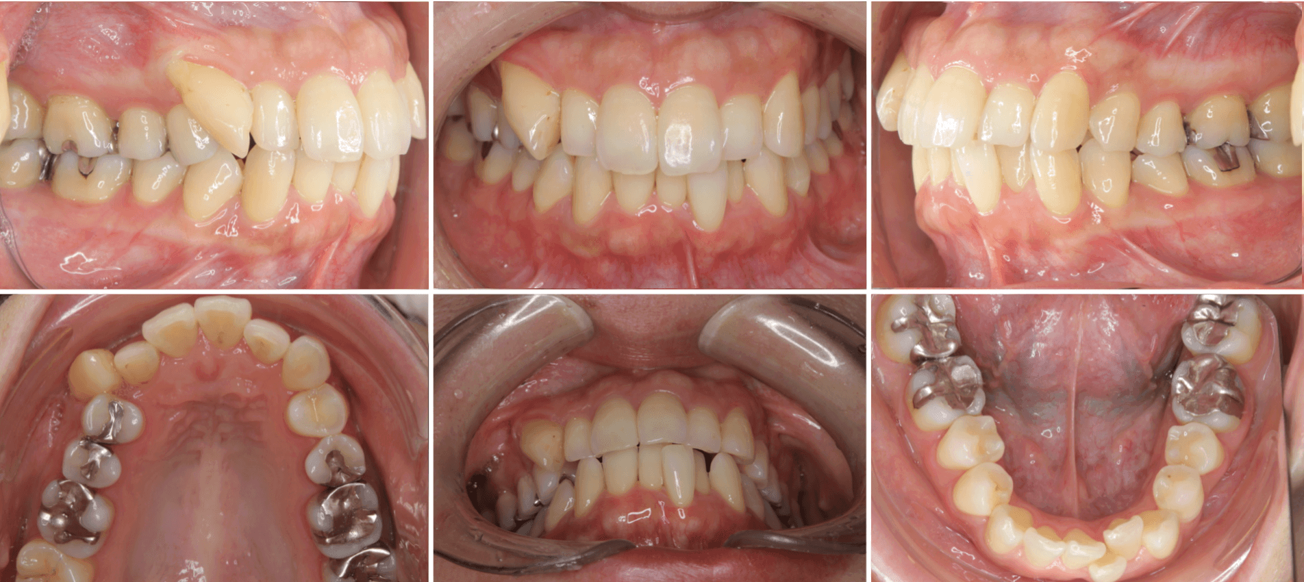 志木　歯医者　矯正