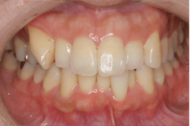 志木　歯医者　矯正