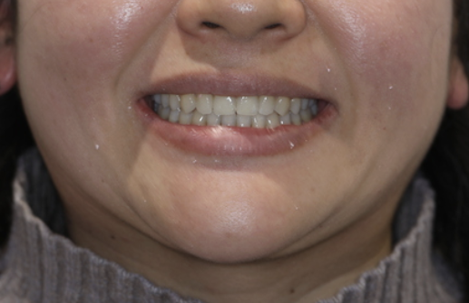 志木　矯正　歯医者