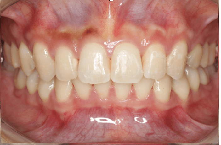 志木　歯医者　矯正