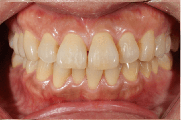 志木　歯医者　矯正