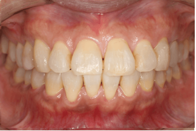 志木　歯医者　矯正