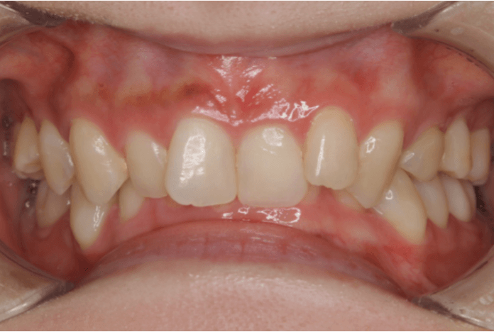 志木　歯医者　矯正